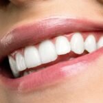 A patient showcasing bright results after receiving professional teeth whitening services in Vista, CA at Alta Vista Dental.